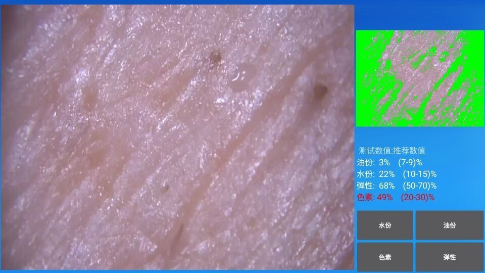 mrkv智能头皮皮肤检测图1