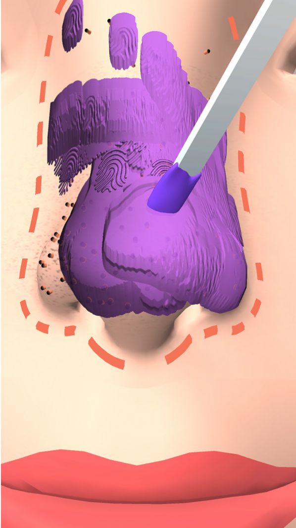 干净的鼻子游戏最新版图2