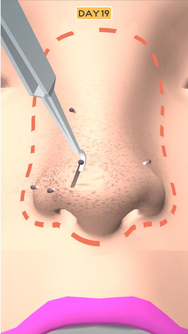 鼻子美容师游戏官方版安卓版 1.0.2图1