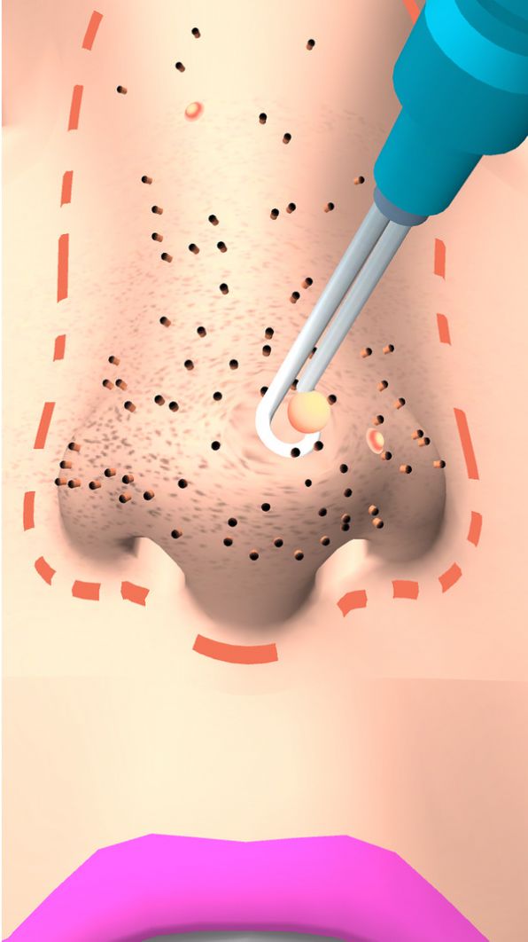 干净的鼻子游戏最新版图3